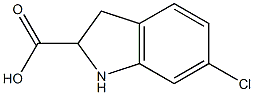 6-Chloro-2,3-dihydro-1H-indole-2-carboxylic acid Structure
